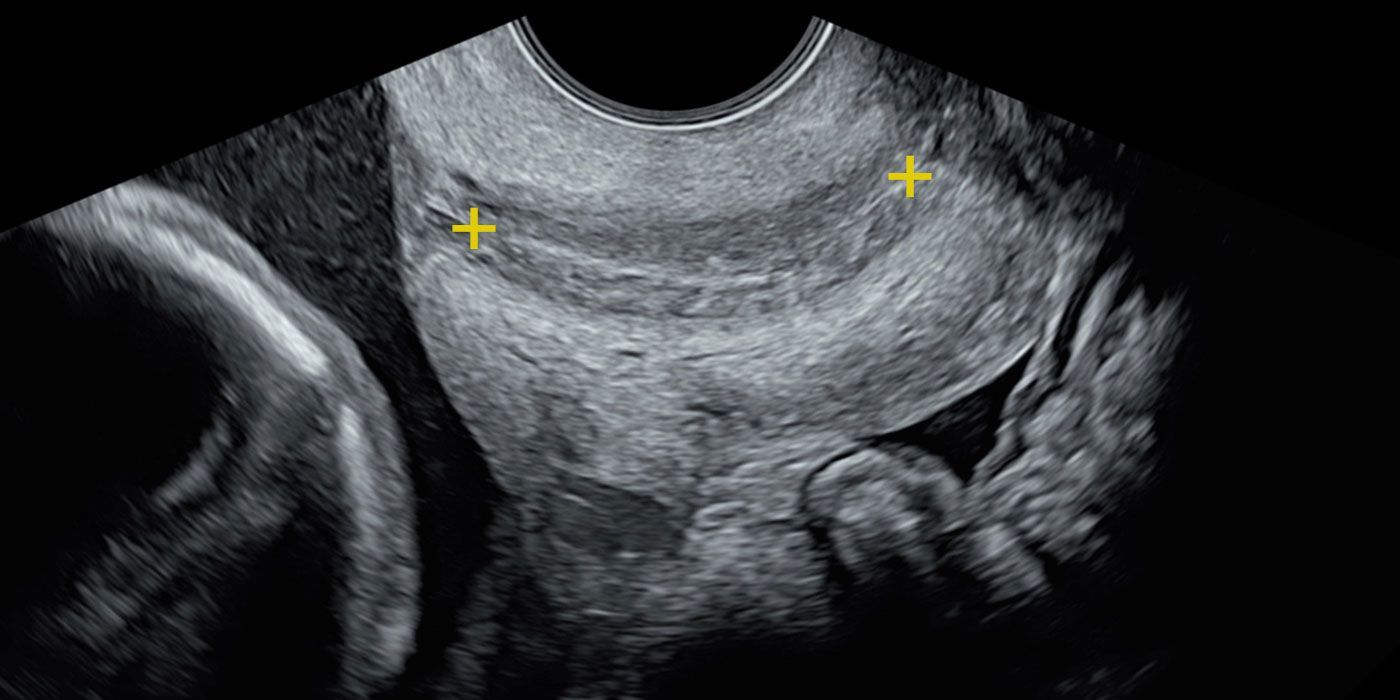 Obstetrics | Australian Fetal Assessment Centre (AFAC) & Gynaecological ...