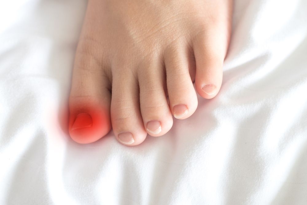 A Close Up of a Person's Foot With a Red Toenail — Craig Hughes Podiatry In Mount Hutton, NSW
