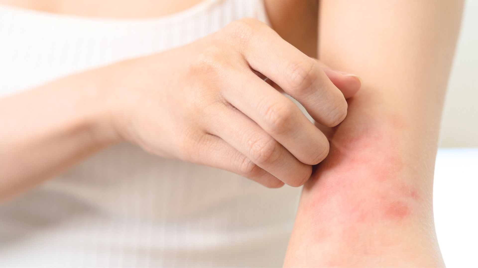 Have you noticed itchiness when taking Wegovy (semaglutide)? Learn what's normal and when to be concerned. Have you noticed itchiness when taking Wegovy (semaglutide)? Learn what's normal and when to be concerned.