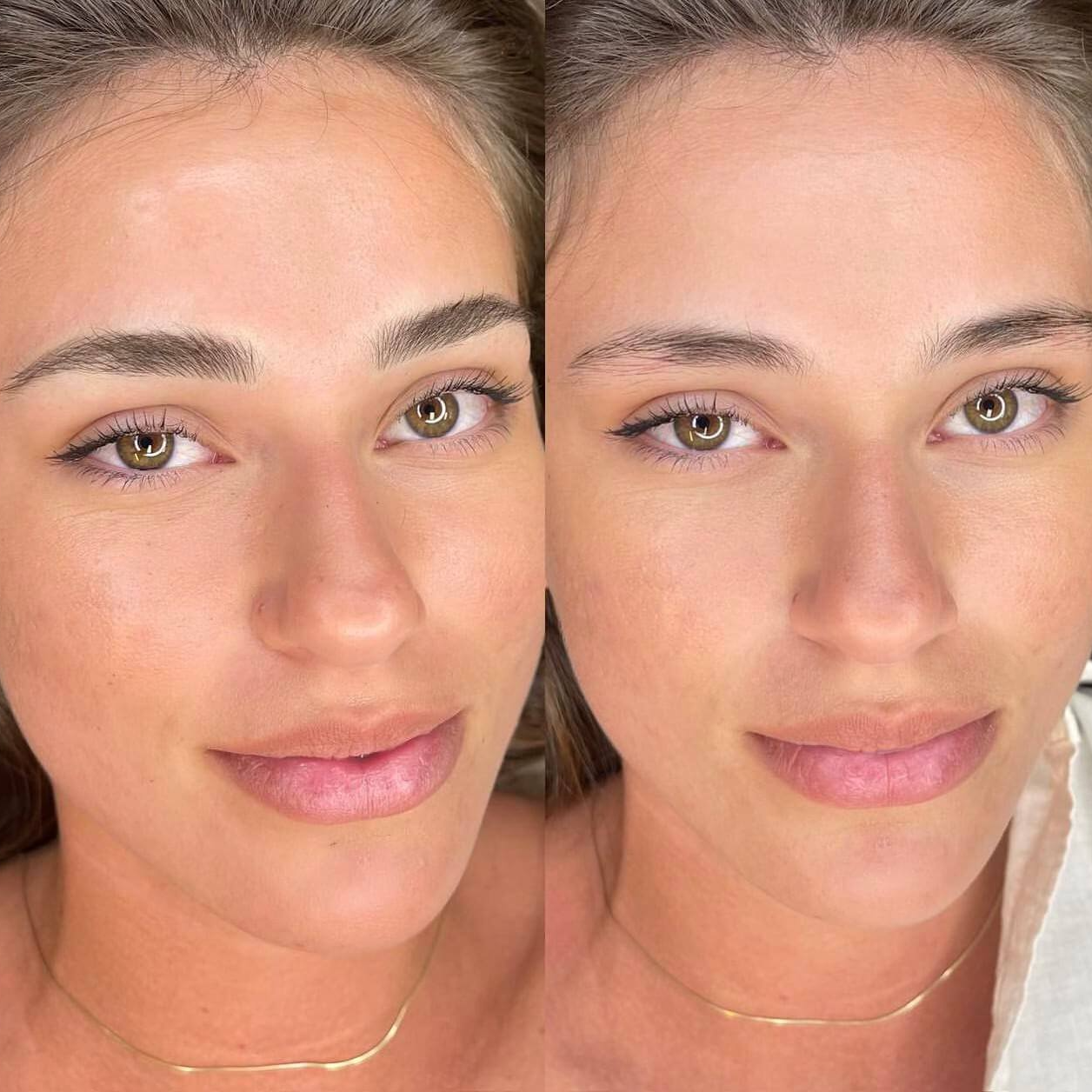 side by side before and after of woman after eyebrow microblading