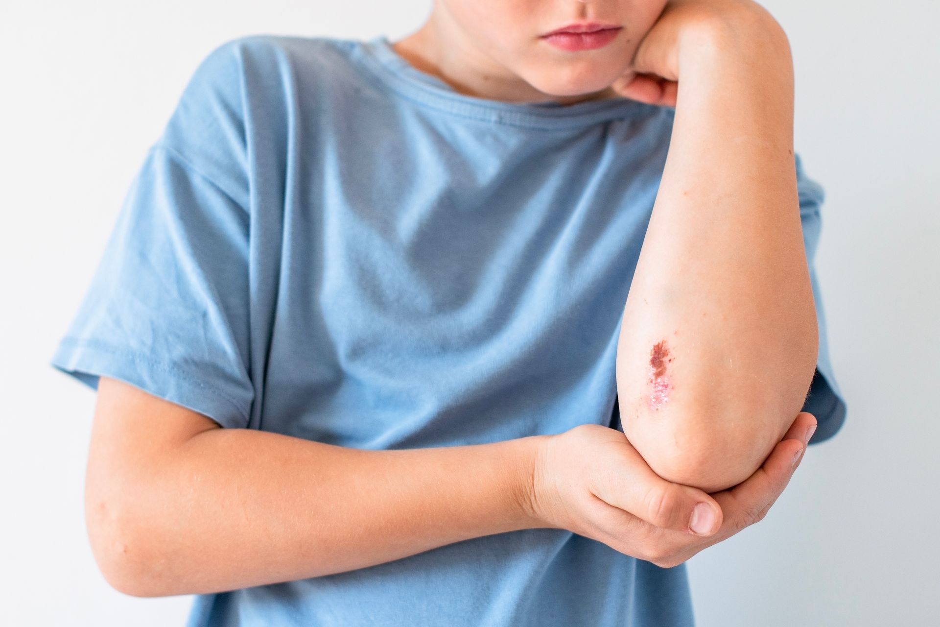 A person holds an arm with a small scrape on the elbow, showing a minor injury against a plain background.