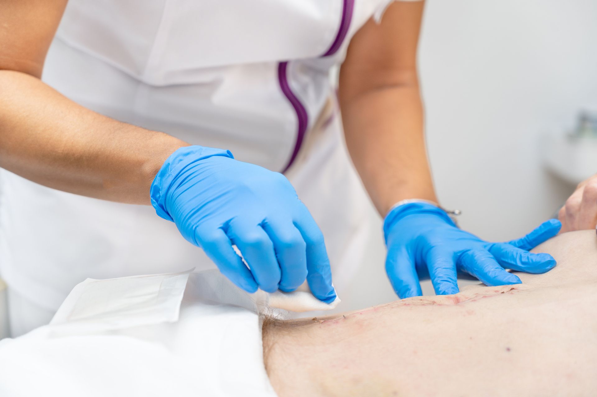 Image of a wound care doctor in Jacksboro, TN, treating a wound on a patient's lower abdomen. Image of a wound care doctor in Jacksboro, TN, treating a wound on a patient's lower abdomen.