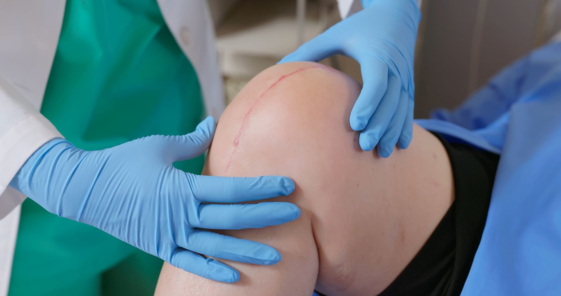 Gloved medic inspects post-surgery scar on patient's knee.