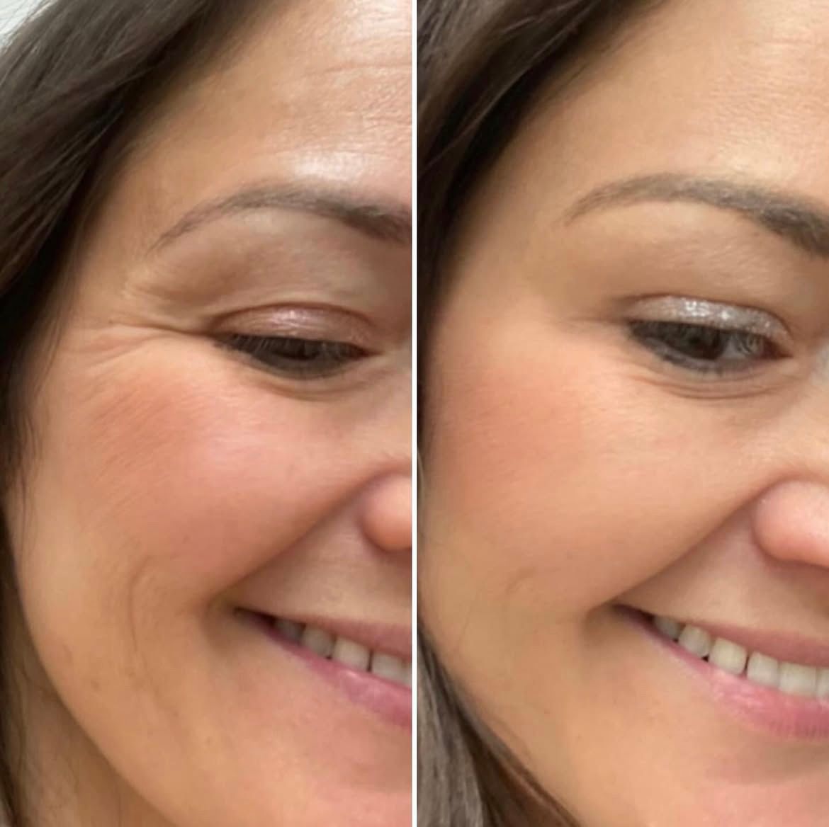 A before and after photo of a woman 's face