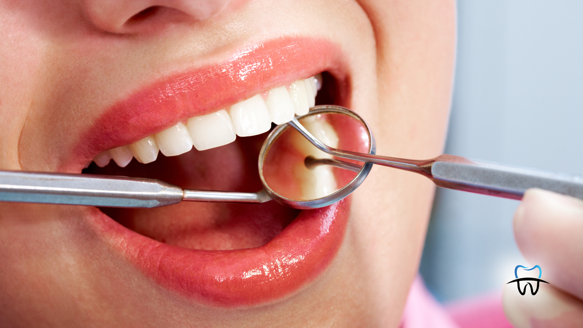 Person's mouth open during a dental checkup. Mirror and probe in use, showing healthy, white teeth.