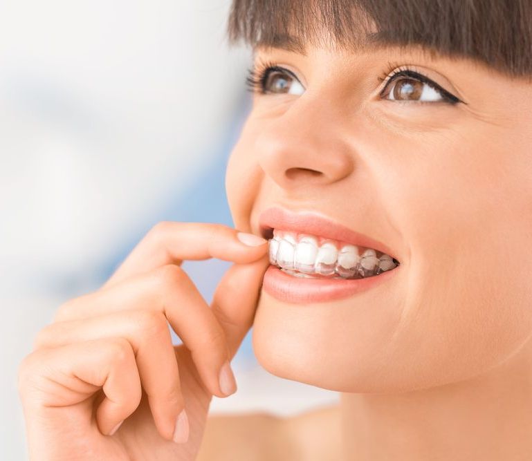 Woman smiling, inserting clear aligner into teeth, light background.