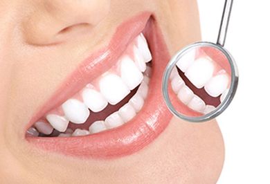 Close-up of a smiling mouth with bright white teeth, viewed with a dental mirror.