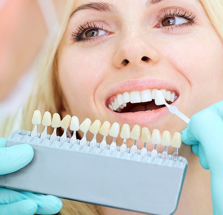 Dentist matching a patient's tooth color using a shade guide in a dental office.