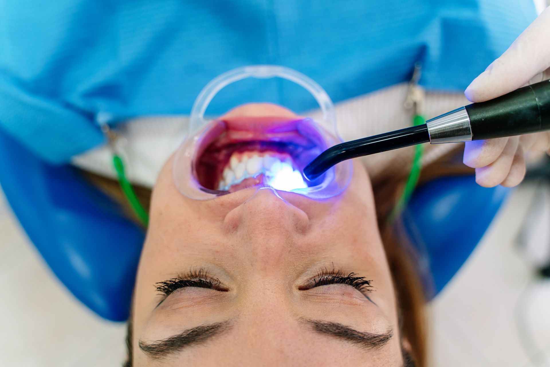 A woman receiving dental care with bright light, showcasing teeth whitening in progress.