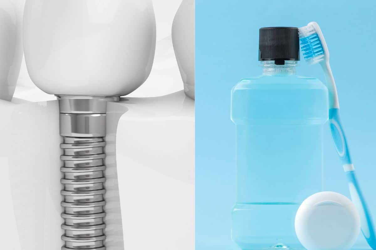 A tooth implant next to a bottle of mouthwash and a toothbrush.