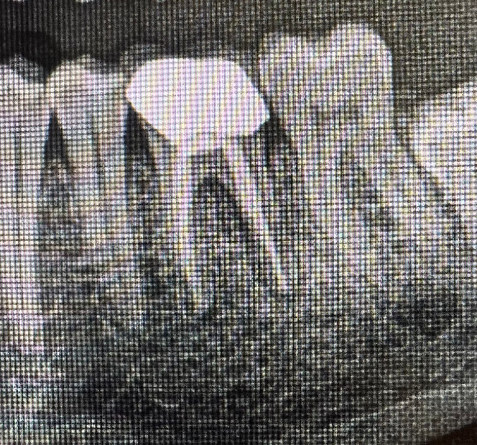 A black and white photo of a person 's teeth.