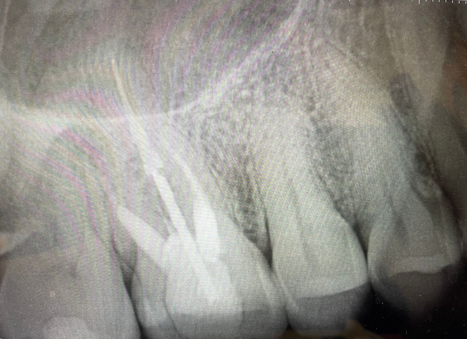 A close up of an x-ray of a person 's teeth.