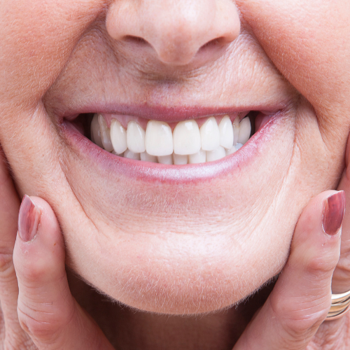 A close up of a woman 's smile with her hands on her face.
