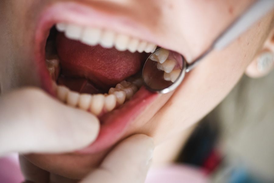 A woman is getting her teeth examined by a dentist.