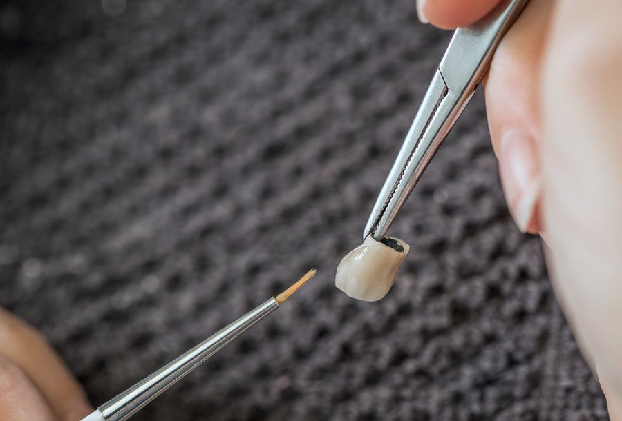A person is holding a pair of tweezers over a tooth