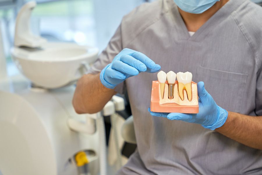 A dentist is holding a model of a dental implant.
