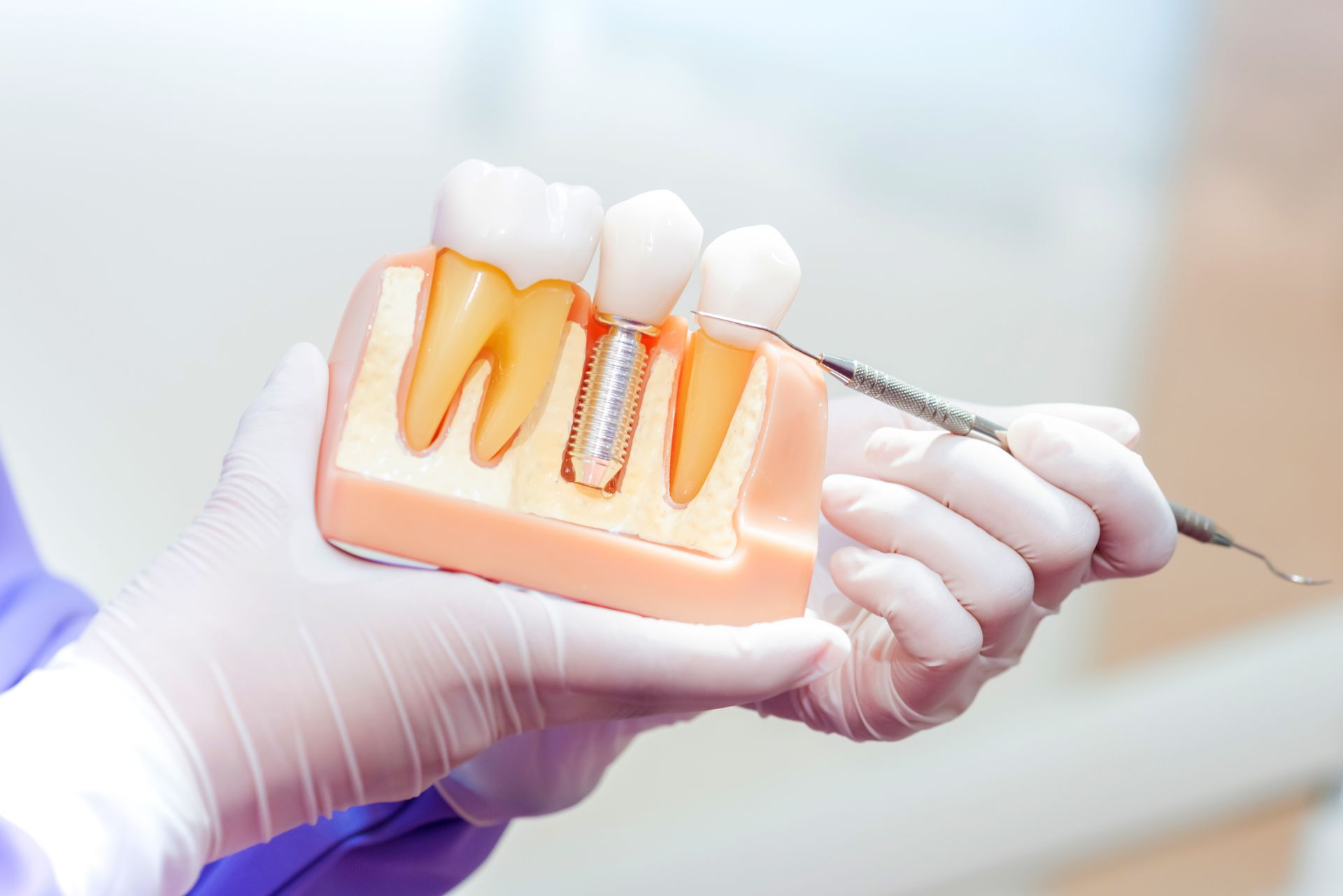 Dentist holding a model of a tooth and dental implant, pointing with a dental tool.