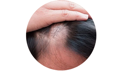capelli trattamento