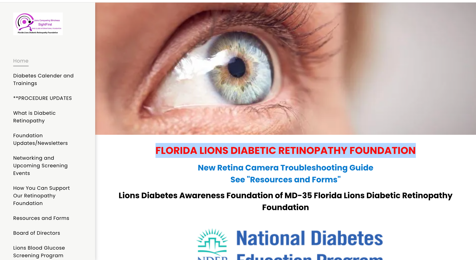 A close up of a person 's eye on a national diabetes website