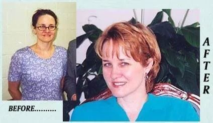 Before-and-after portrait collage of a smiling woman, with “BEFORE” on the left and “AFTER” on the right.