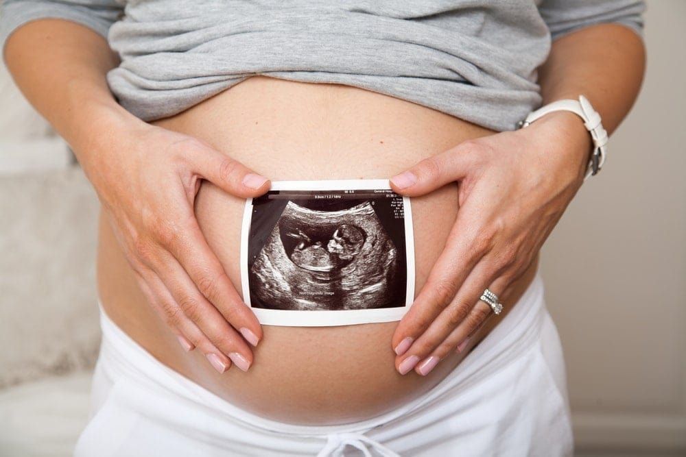 Zwangere vrouw houdt echografiebeeld boven haar buik.