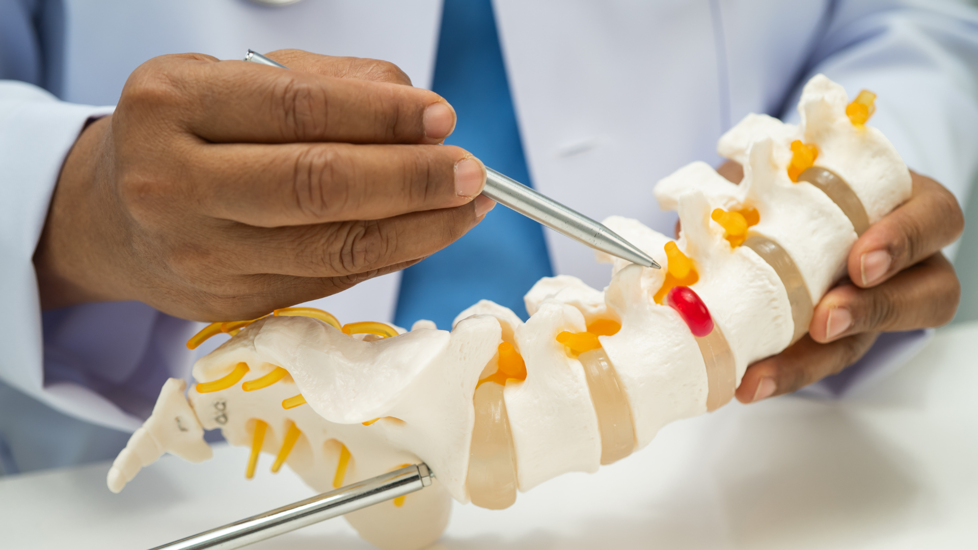 Hand using a dental tool on a model of a human spine with yellow pain markings