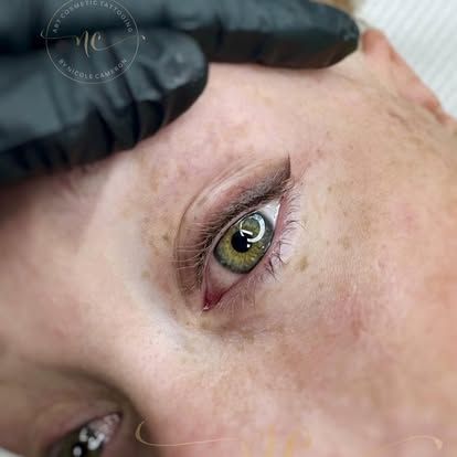 Close-up of a hazel eye with a gloved hand holding the forehead during an eye exam