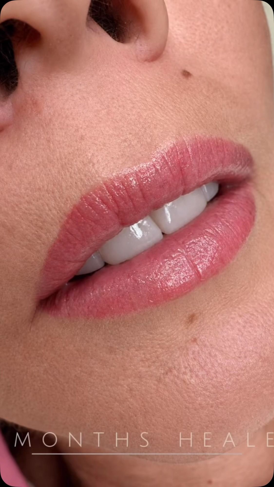 Close-up of lips with glossy pink lipstick and a small beauty mark on the cheek