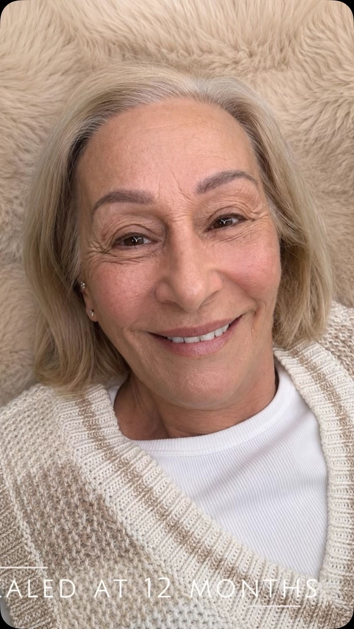 Smiling person lying on a beige textured blanket, wearing a cream sweater and white top.