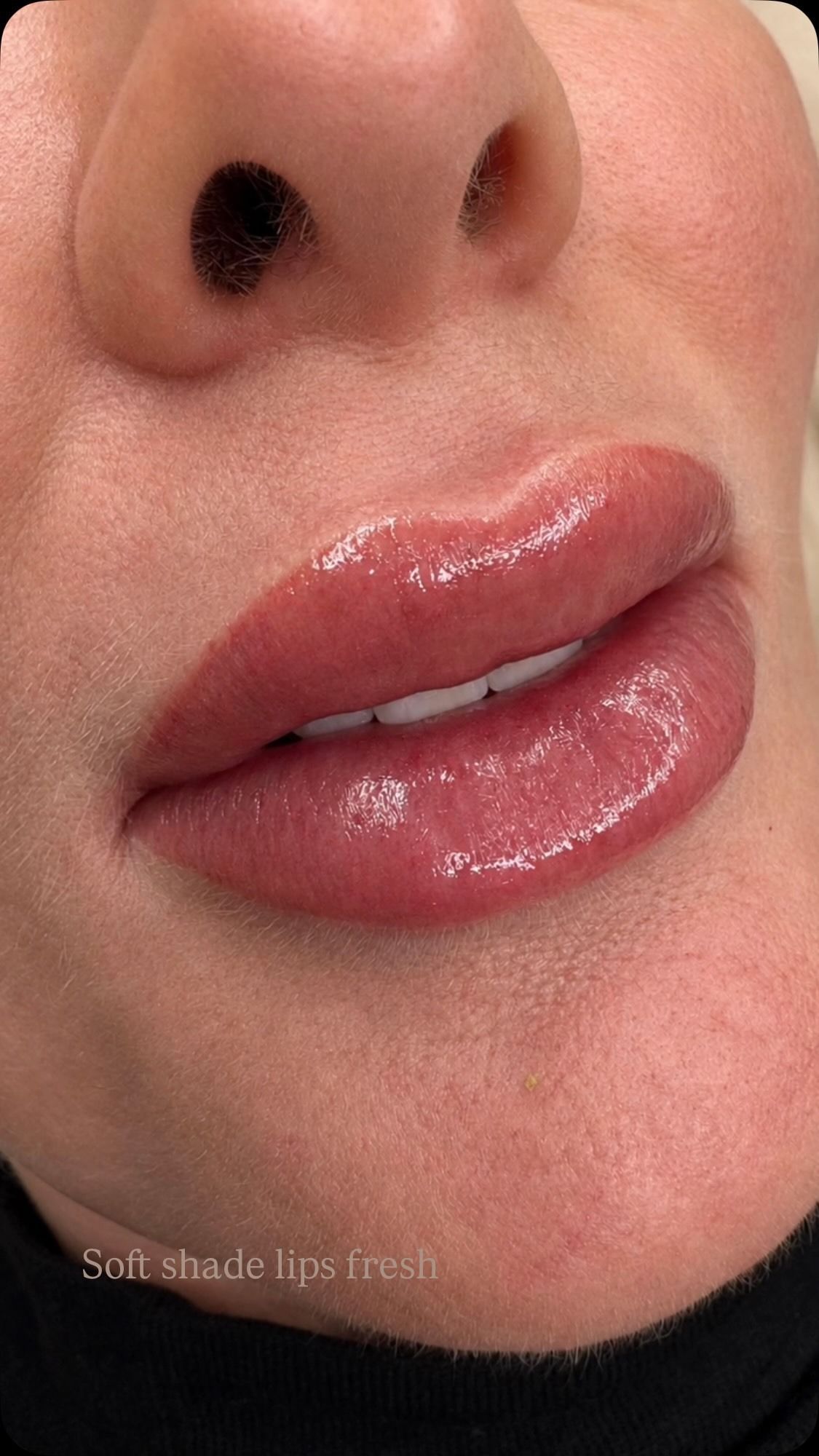 Close-up of glossy pink lips and nose on a face, with soft makeup and skin tones