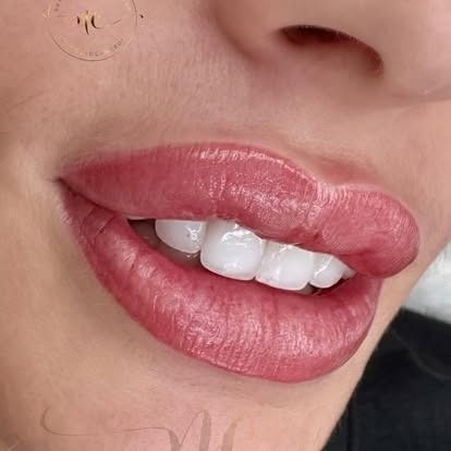 Close-up of glossy pink lips slightly parted, showing white teeth and a nose piercing.