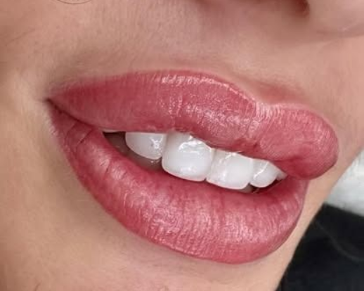 Close-up of glossy pink lips slightly parted, showing white teeth.