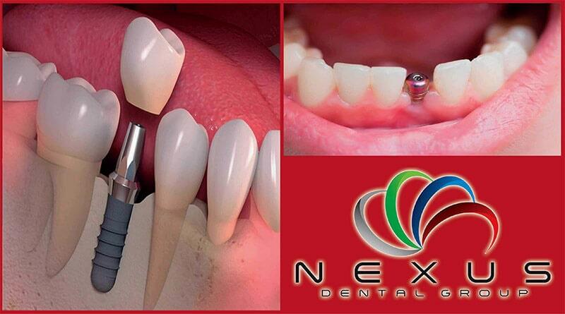 NEXUS DENTAL GROUP NEXUS DENTAL GROUP