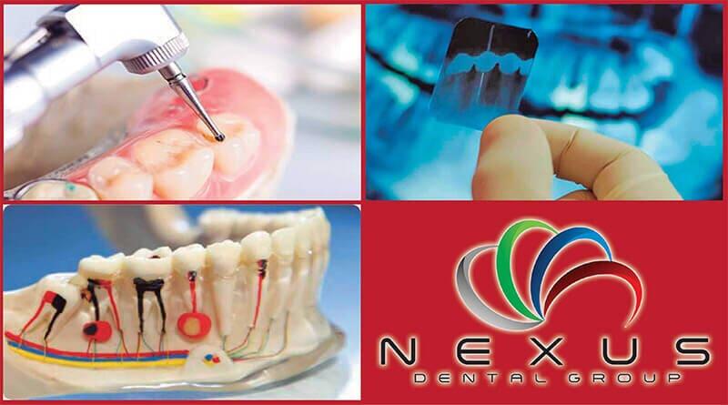 NEXUS DENTAL GROUP NEXUS DENTAL GROUP