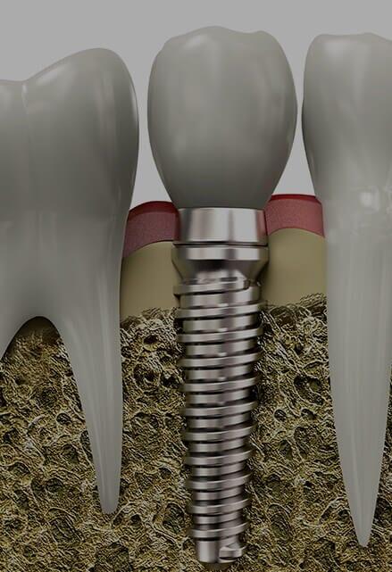 NEXUS DENTAL GROUP NEXUS DENTAL GROUP