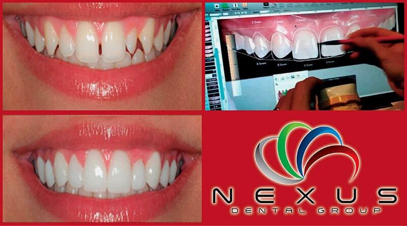 NEXUS DENTAL GROUP NEXUS DENTAL GROUP