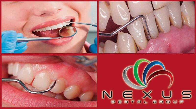 NEXUS DENTAL GROUP