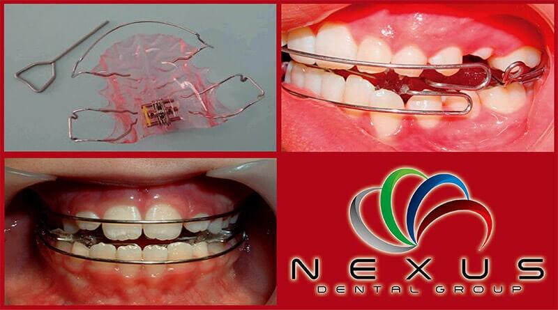NEXUS DENTAL GROUP NEXUS DENTAL GROUP