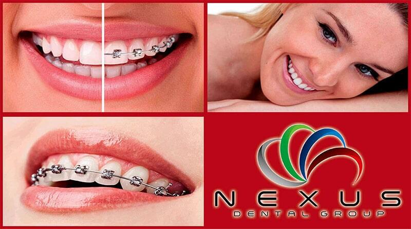 NEXUS DENTAL GROUP NEXUS DENTAL GROUP