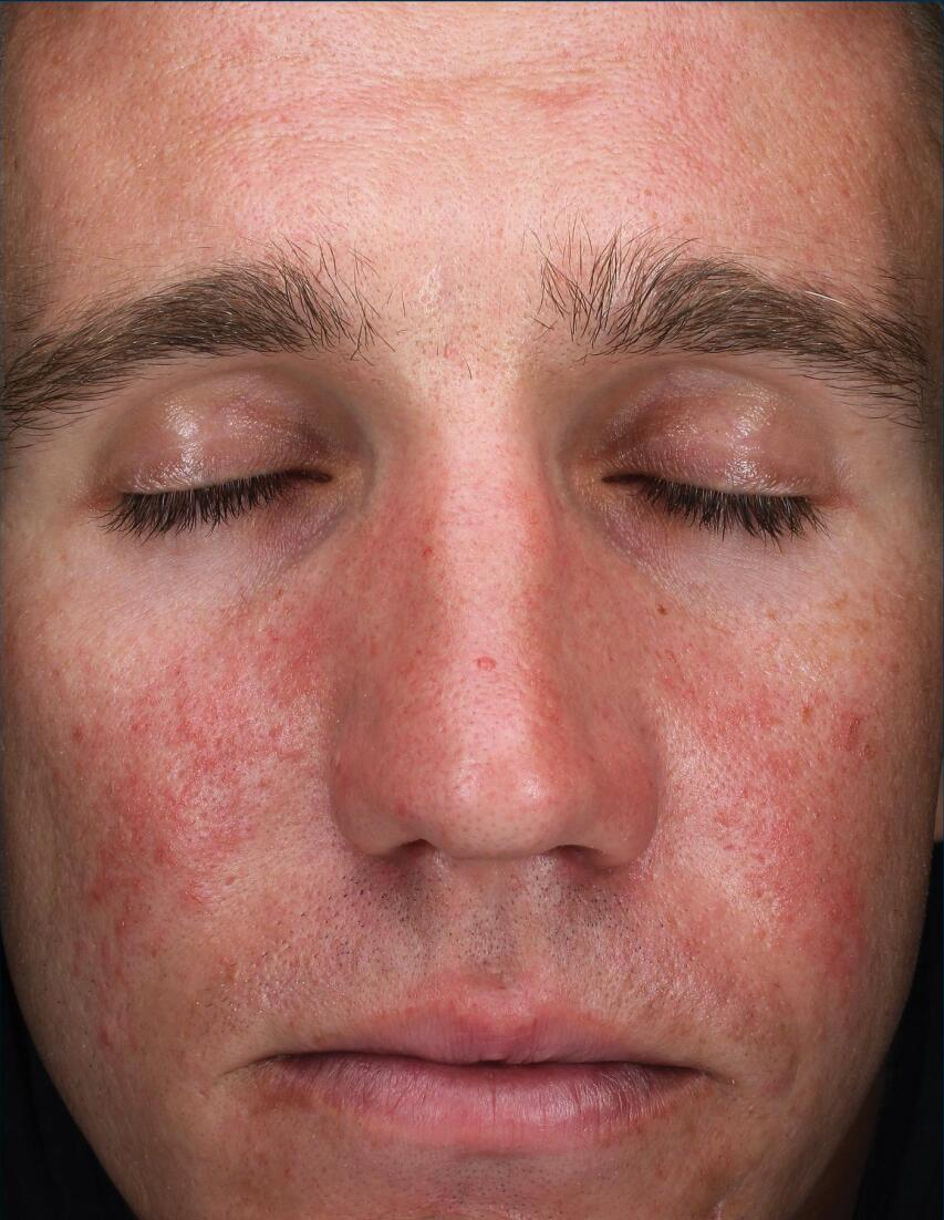 A close up of a man 's face with his eyes closed.