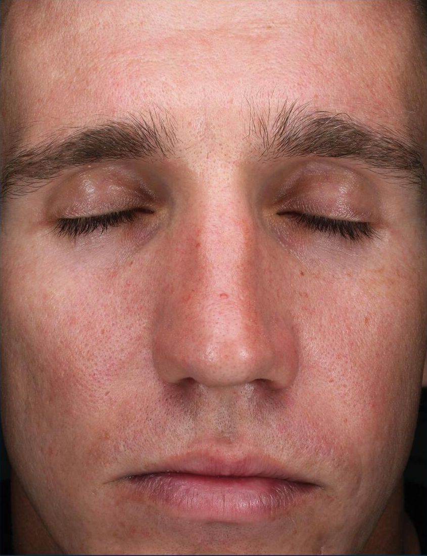 A close up of a man 's face with his eyes closed.