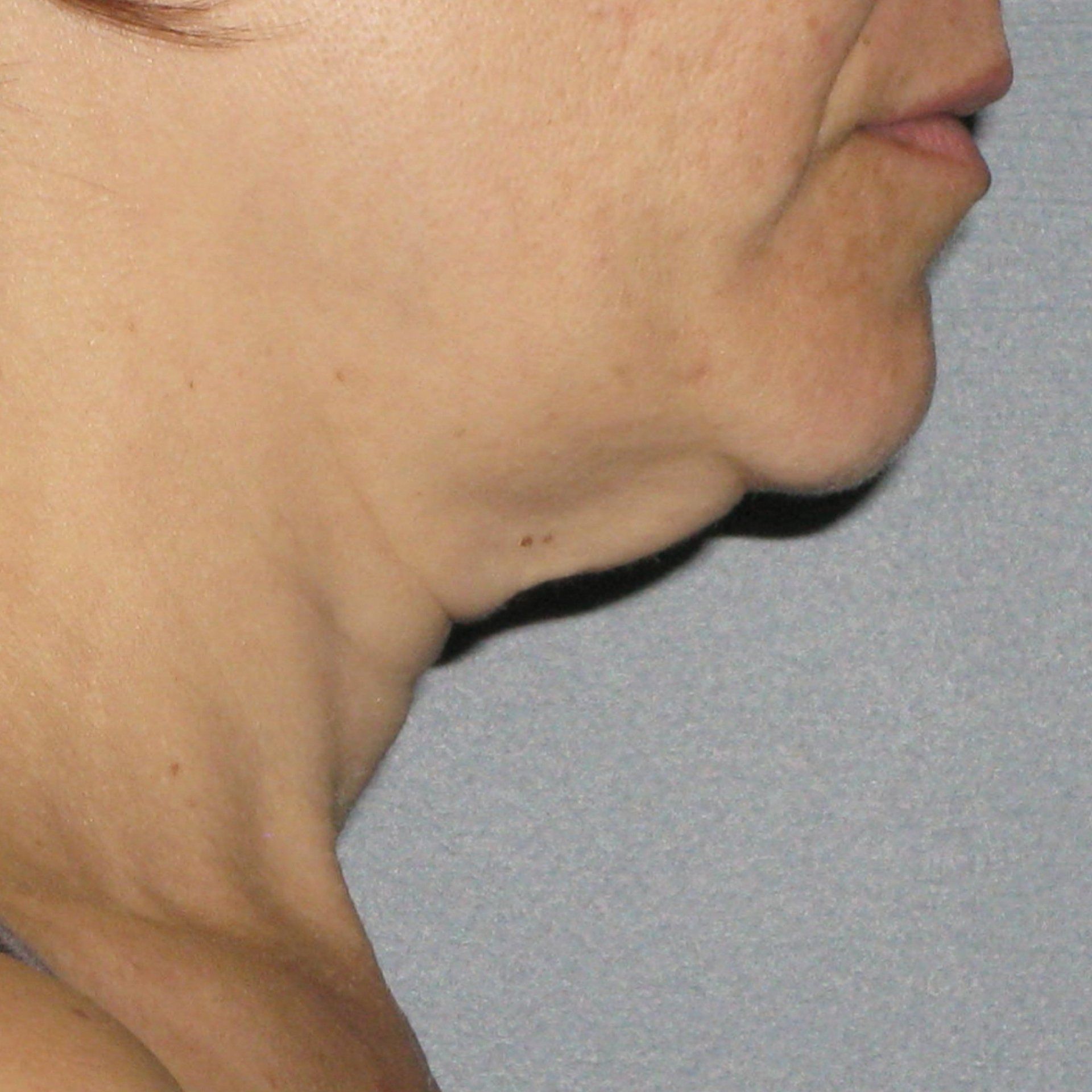 A close up of a woman 's neck with a double chin.
