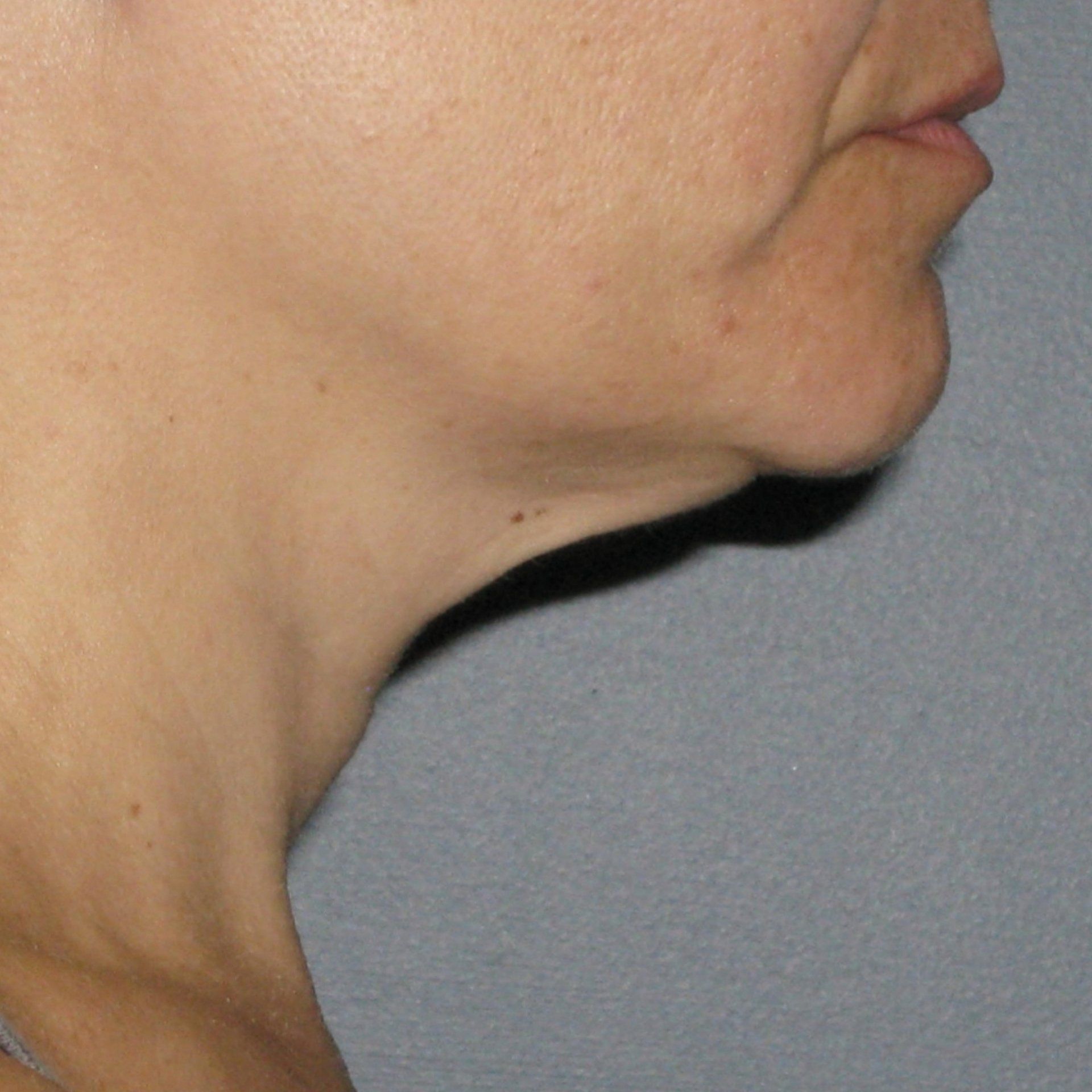 A close up of a woman 's neck and chin.