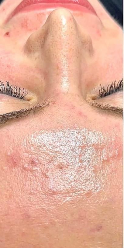 A close up of a woman 's face with a white spot on it.