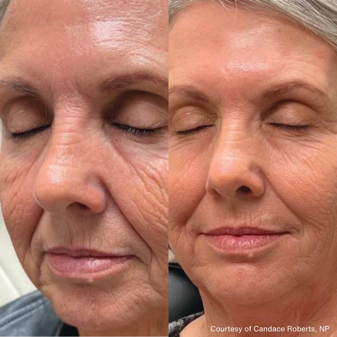 Medical grade skincare in Union, SC