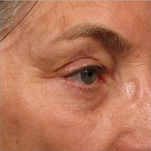 A close up of an older woman 's eye with wrinkles.