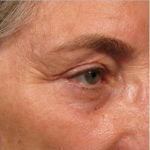 A close up of a woman 's face with wrinkles and a blue eye.