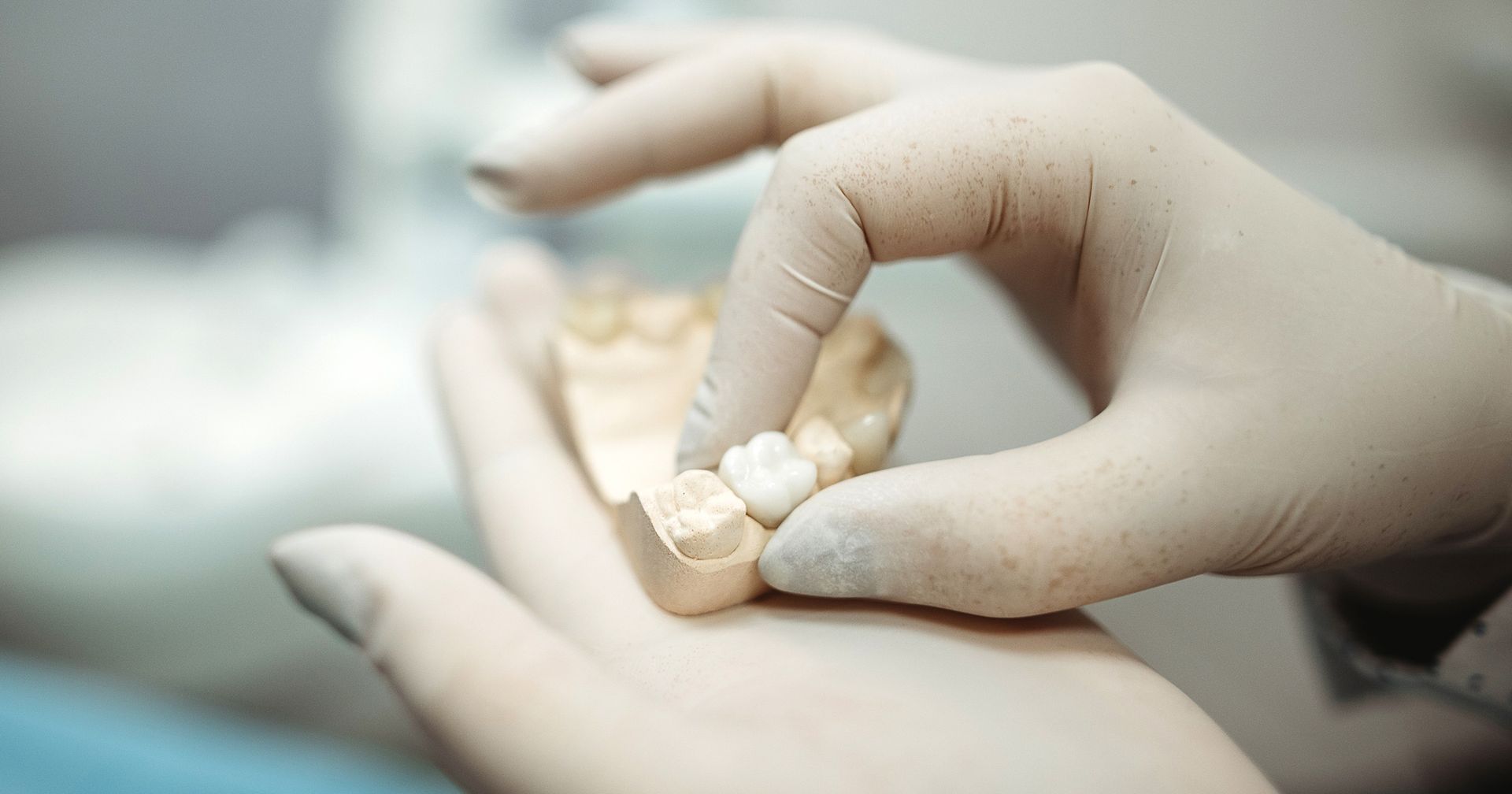 dental crowns in Arlington Heights IL