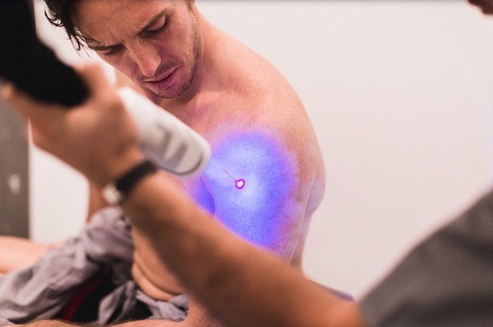 a male client getting a cryotherapy spot treatment on his shoulder, a recent problem area of him