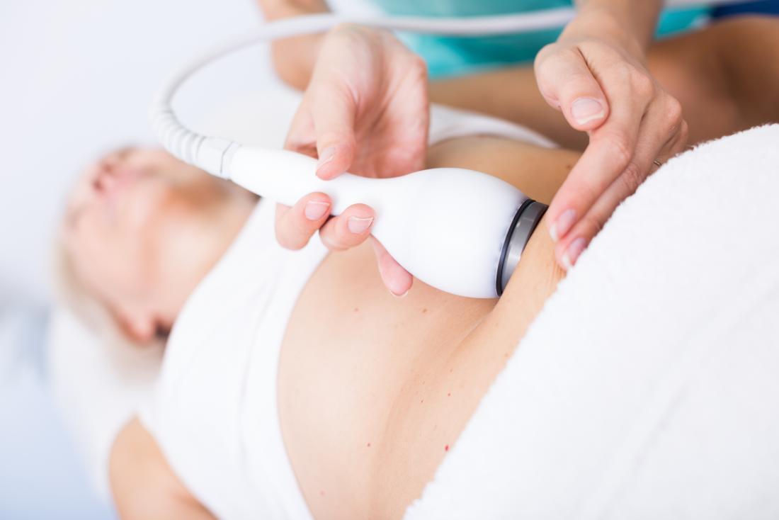 female client getting cryotherapy fat/cellulite dissipation services